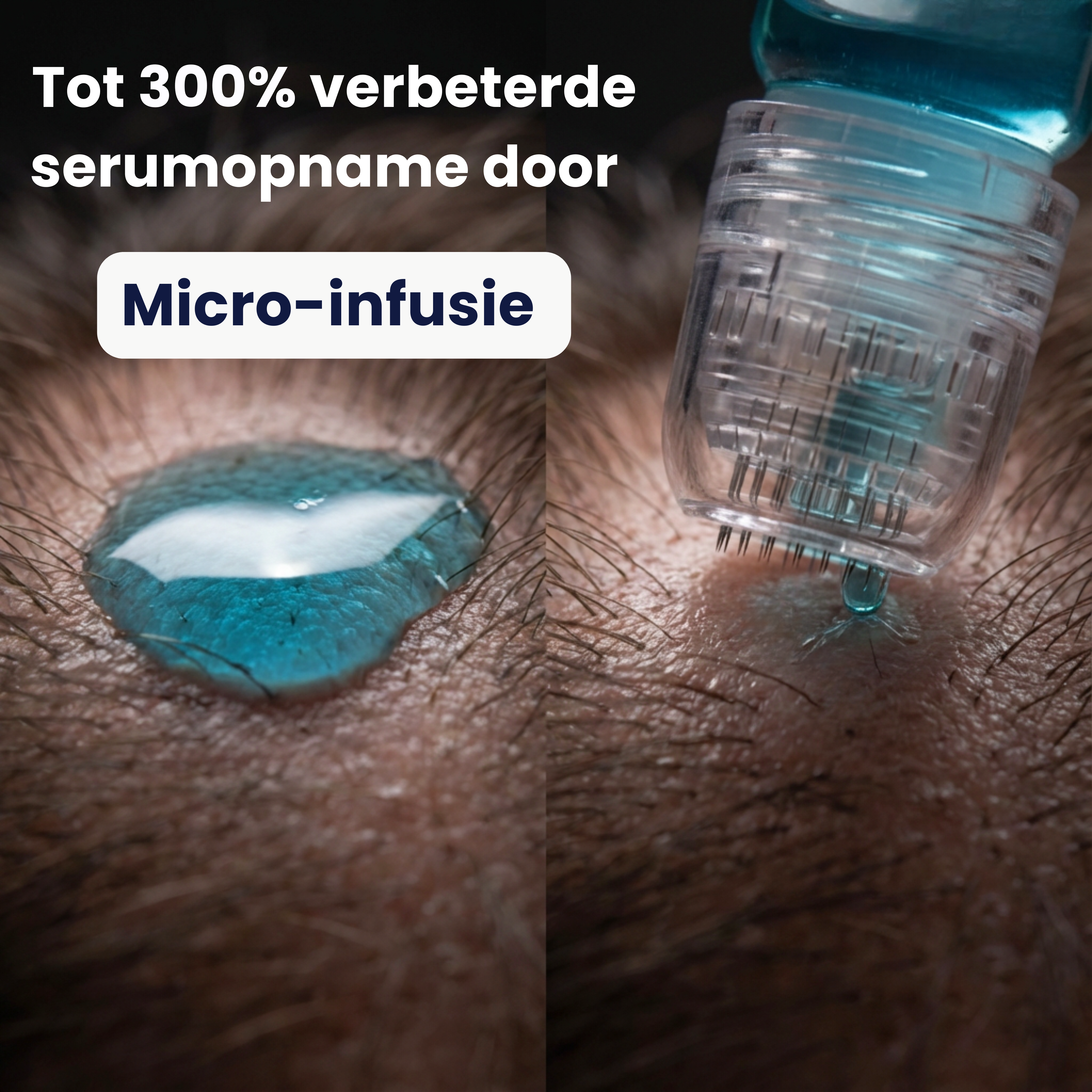 ORVICKS™ Hair Growth Kit