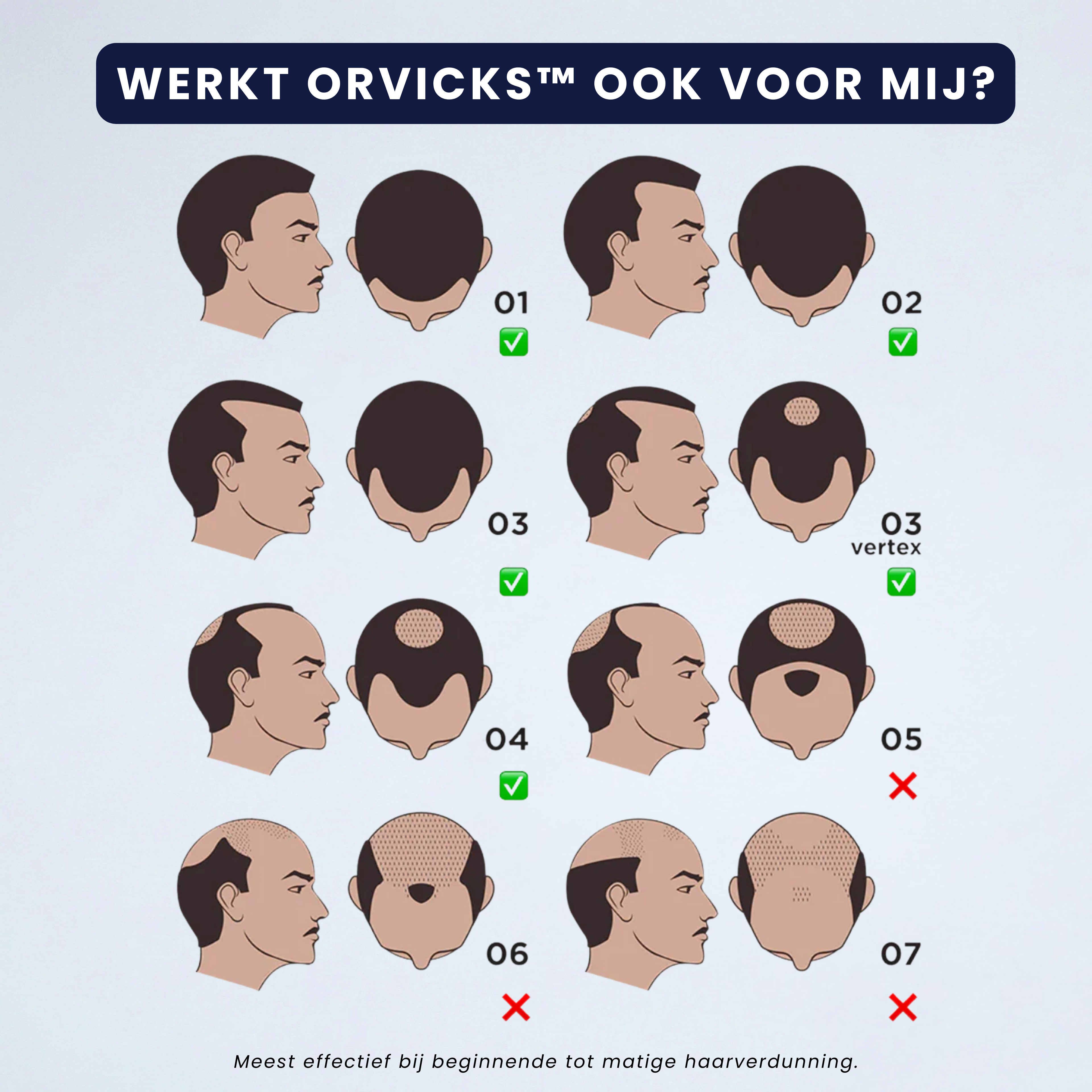 ORVICKS™ Hair Growth Kit