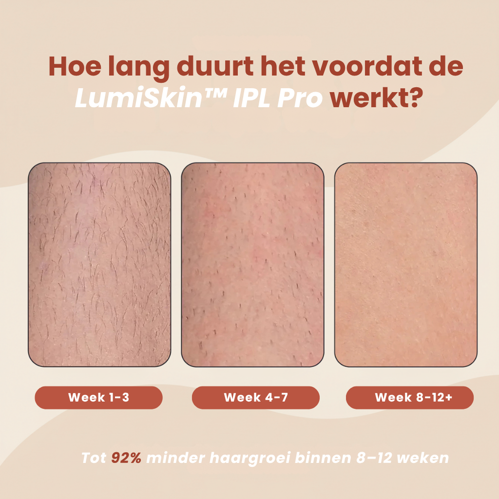 LumiSkin™ IPL Pro orvicks